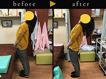 杉本接骨鍼灸院/背骨から全身がユルユル整体