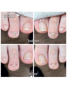 爪切り屋 足楽/