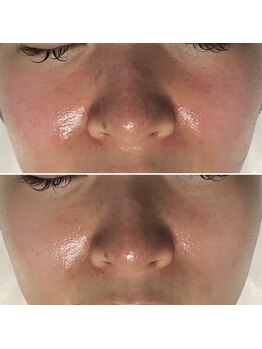 レアリゼ(Realiser)/クリスティーナ☆アンストレス