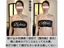 ソウ バイ ソウ(So by 蒼)/全身[調律]小顔矯正・1回の結果!