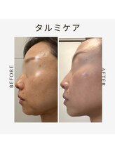 ツヤハダコガオ 千葉店/before⇒after【レモンボトル】