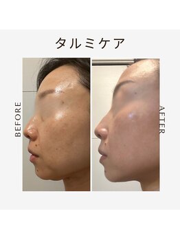 ツヤハダコガオ 千葉店/before⇒after【レモンボトル】