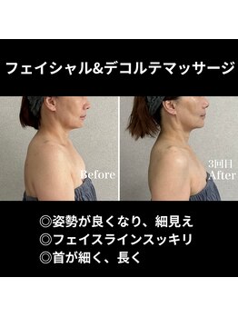 シュ シュ(chou chou)/オールハンドマッサージです