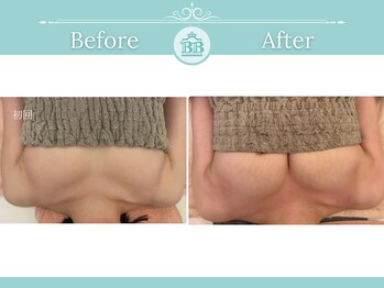 美人バスト 浜松店/◇ バストアップ &nbsp;BeforeAfter◇