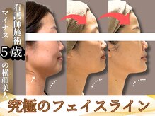 ユニ(Uni)