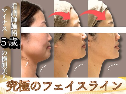 ユニ(Uni)の写真