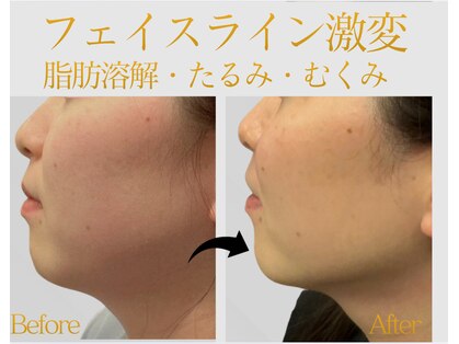 モミン(MOMI.N)の写真