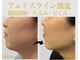 モミン(MOMI.N)の写真