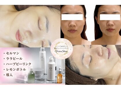 グレイスシャイン(GraceShine)の写真