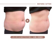 イエス マイサロン(yes My Salon)の雰囲気(【奇跡の美容液レモンボトル】韓国発の最新脂肪分解施術)