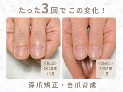 エオック(EOQC)の写真