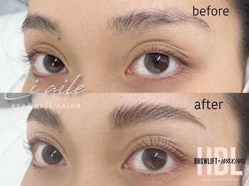 リエル(liaile)/ハリウッドブロウリフト