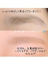 アイル(I'll)/ビフォアー、アフターで比べて☆