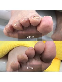 ドクターネイル爪革命 北千住店/トータルフットケア