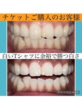 ホワイトニングビューティー 村上店(Whitening Beauty)/白いTシャツに負けない歯