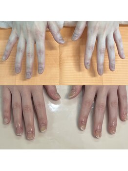 ハッカネイル(HAKKA NAIL)/