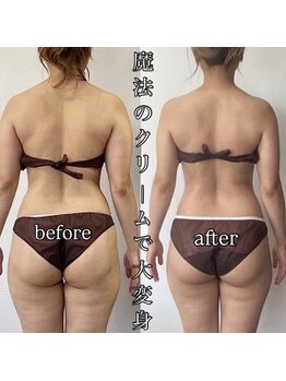 エヌボーテ(N. beaute)/全身痩身コース#4回目