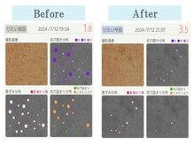 ゴールデンケア 岡崎店(Golden Care)/シミ・毛穴洗浄・フェイシャル