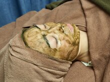 ビハダ(BIHADA)/韓国で開発！ハーブピーリング