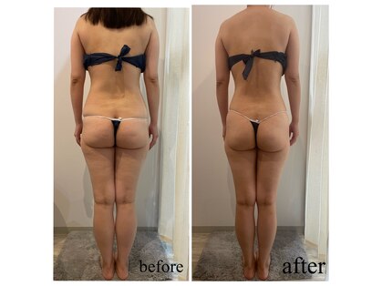 ドリームローズ(Dream Rose)の写真