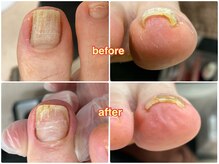 ヴィアンジュ 浦和コルソ店(Vie Ange)の雰囲気（フットのお悩みもご相談ください♪）