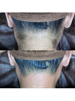 エンジェルワックス 蒲田店(Angel Wax)/【うなじワックス】