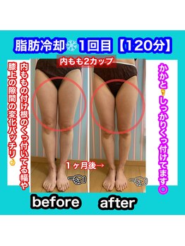 ビューティ ウィッチ(Beauty Witch)/いらない物は凍らせポイッ