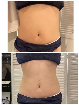 サロン ルイス アディクト(salon Lewis Addict)/