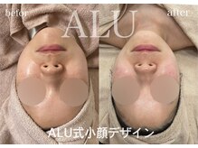 アルフォービューティ 広島店(ALU FOR BEAUTY)/ALU式小顔デザイン