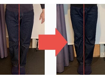 リベスト(RE:BEST)/【全身矯正】ウエストサイズ改善