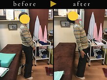 杉本接骨鍼灸院/背骨から全身がユルユル整体