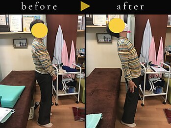 杉本接骨鍼灸院/背骨から全身がユルユル整体
