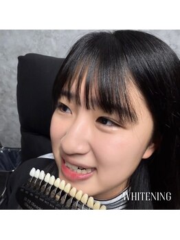 カイリー(KYREE)/WHITENING