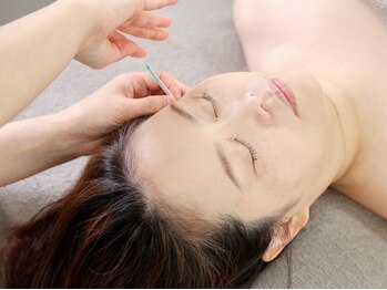 トゥルーカラーズの写真/美の専門家で実績のあるオーナーが贈る感動の鍼灸施術をご体験下さい！【鍼灸＋アロマ60分　¥9900～】
