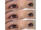 アポン(Apom)の写真