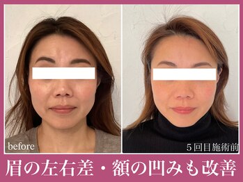 アクアビー(AQUA-B)/