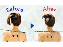 ブライダルエステでドレスが似合うお背中に！