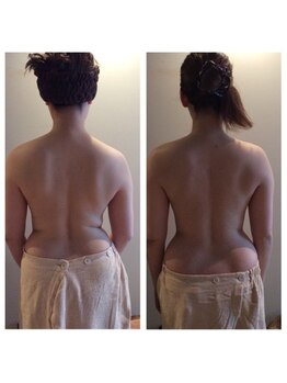 ブルームーン コルギアンドエステティック(Blue moon)/上半身コルギbefore after