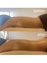 リュミエール デスポワール(lumiere d'espoir)/ホットストーンアロマリンパ