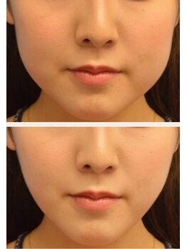 アンベリ(Embelli)/