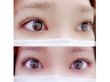 アドヴァンス ロンズ(advance RON'Z)