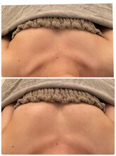 美人バスト 新宿店/☆姉妹店バストアップ症例写真☆