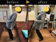 杉本接骨鍼灸院/若々しい背骨を取り戻す整体