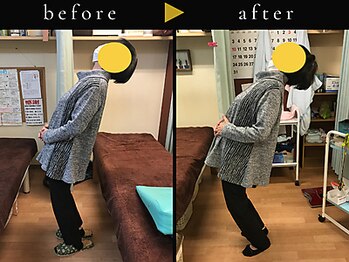 杉本接骨鍼灸院/若々しい背骨を取り戻す整体