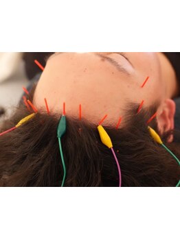 メンズにオススメのサロン