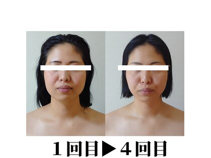 ニコ(Nico)の写真