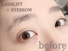 アリュージョン 天王寺北口店/眉毛×まつげパーマ/before