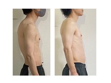 リンクの雰囲気（お客様のお悩みは猫背。筋膜リリースで骨格が正常な位置に改善★）