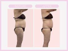 スリムライン 八戸店(The Slim Line)/before→after