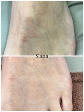 サナ 久が原 千鳥町(S’ana)/ルビッシュ照射